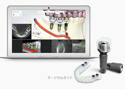 デジタル技術を活用した診断とシミュレーション
