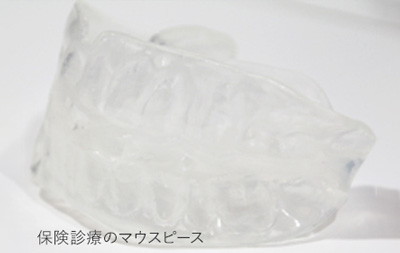 保険適用のマウスピース