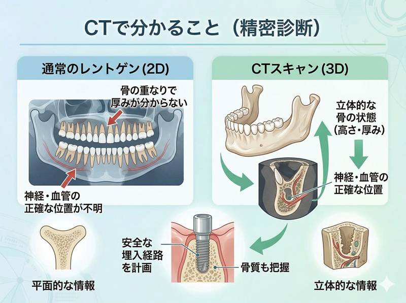 CTで分かることの解説図