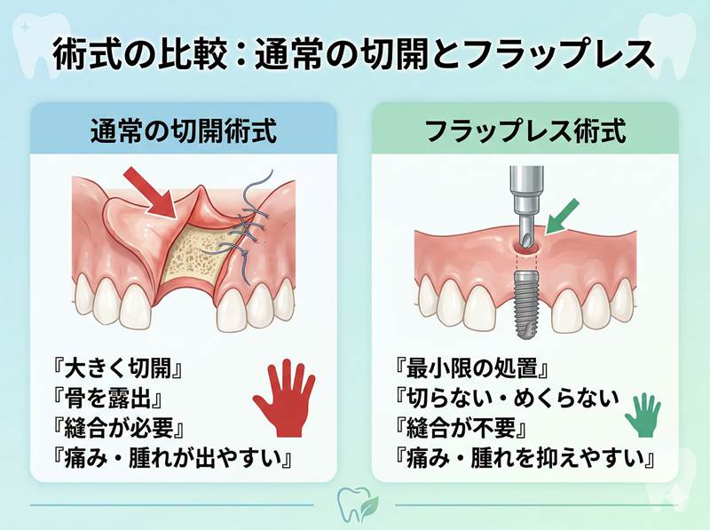 切らないインプラント解説図１
