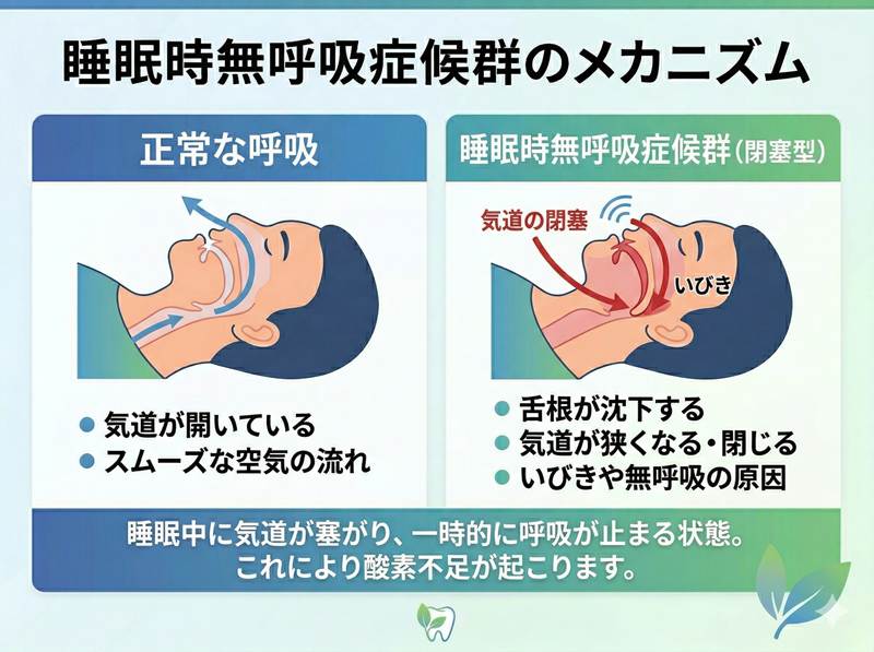 睡眠時無呼吸症候群のメカニズム